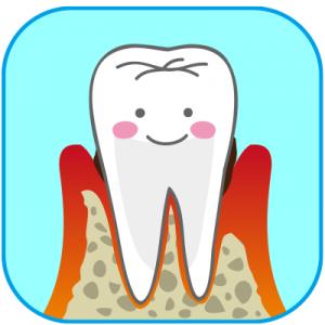 歯周病の治療イメージ